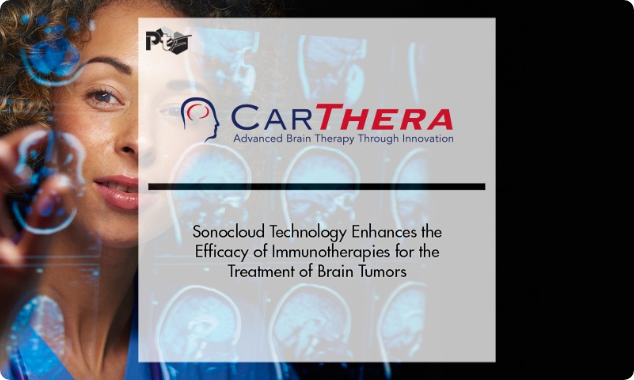 Cartheras-Sonocloud-Technology-Enhances-the-Efficacy-of-Immunotherapies-for-the-Treatment-of-Brain-Tumors@2x