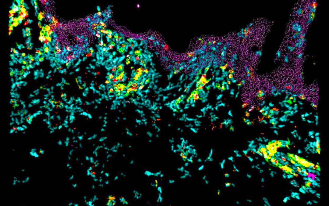 Genoskin launches MANTIS, a spatial biology imaging platform dedicated to skin immunology